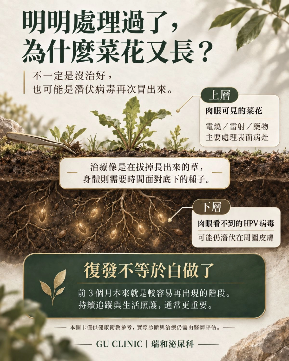 確診菜花別慌!圖解 HPV 病毒潛伏與除草理論 菜花與 HPV 病毒的除草理論圖解:說明電燒或雷射手術如同拔除表面雜草(疣體),而土壤底層潛伏的病毒種子,需要時間與自體免疫力來代謝,幫助病患正確面對復發。
