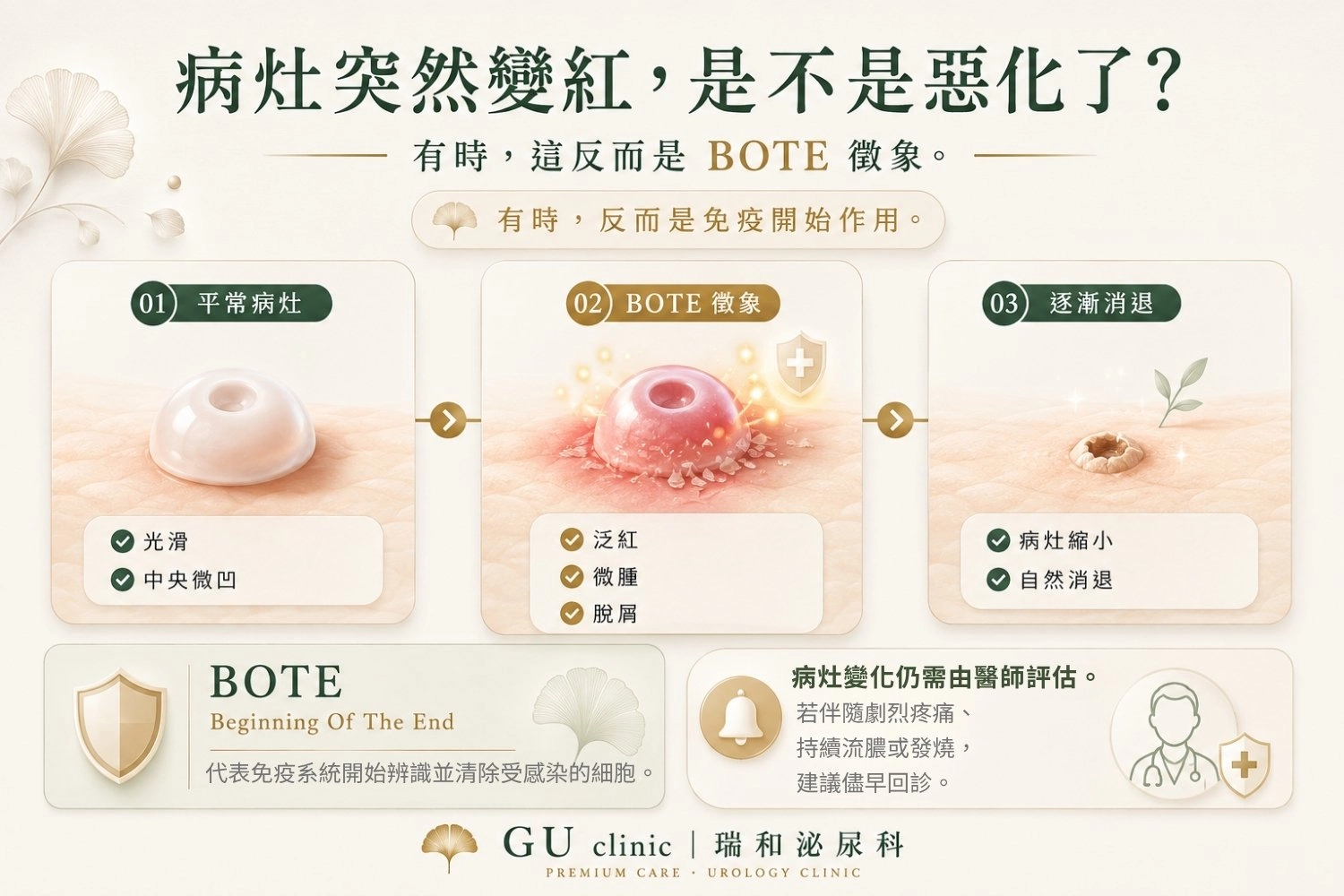 BOTE徵象-免疫系統啟動 瑞和泌尿科傳染性軟疣衛教圖卡,說明 BOTE 徵象的病程變化,從平滑病灶、出現泛紅脫屑,到逐漸自然消退,協助了解免疫系統開始清除受感染細胞的過程。