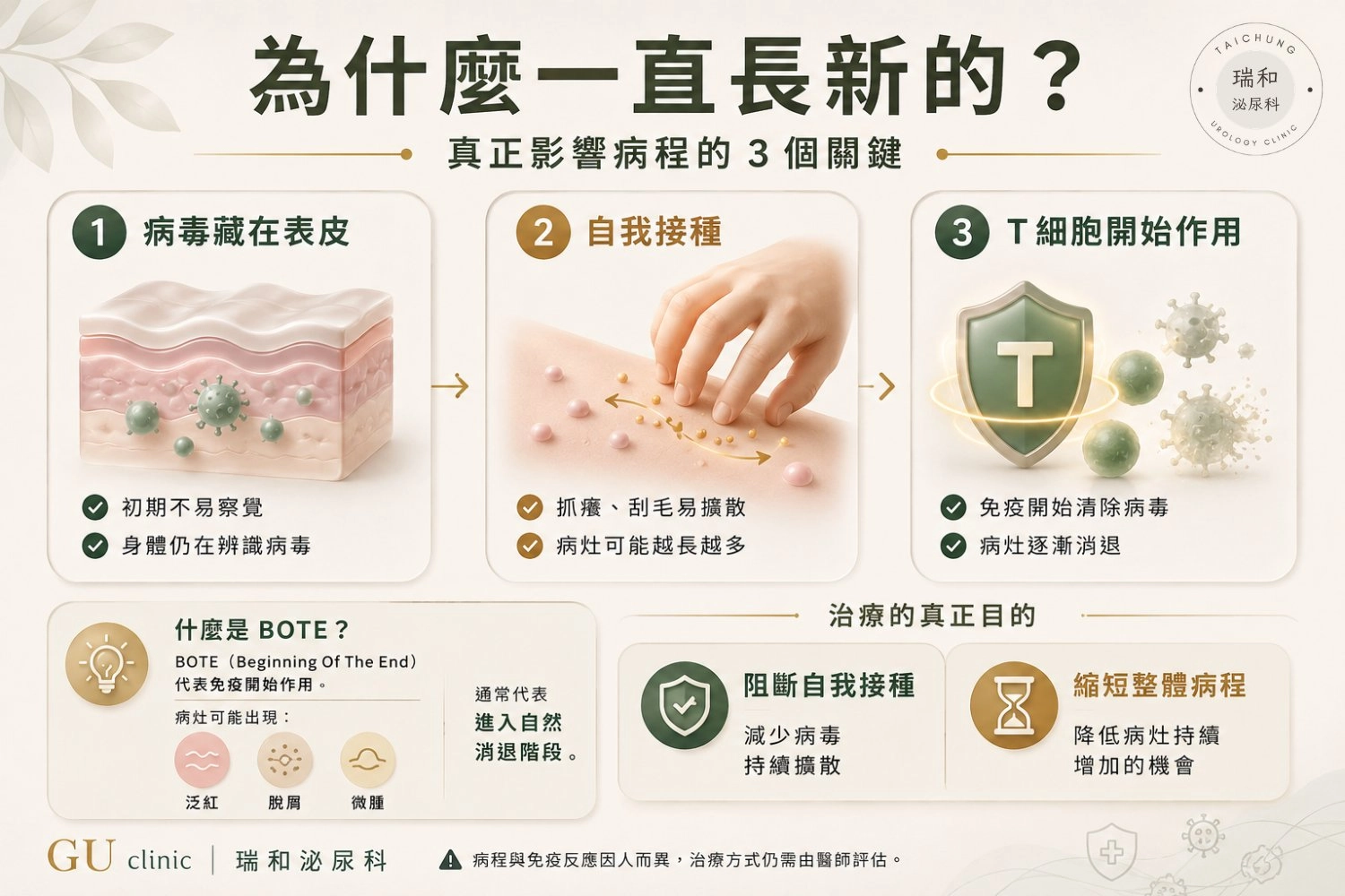 傳染性軟疣為什麼一直長 瑞和泌尿科衛教圖卡,說明傳染性軟疣病程與病灶持續增加的原因,包含病毒藏於表皮、自我接種、T 細胞免疫反應、BOTE 徵象,以及治療協助阻斷自我接種、縮短病程的重點。